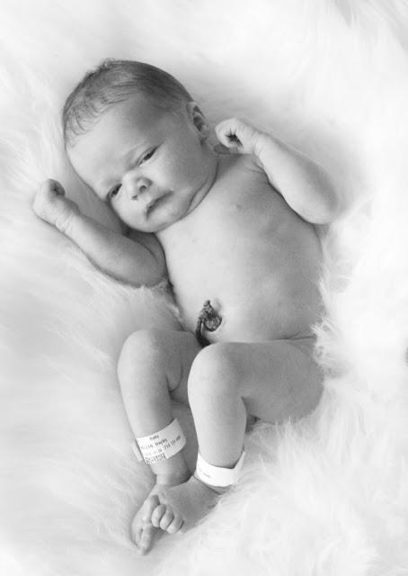 2 weeks post partum c section