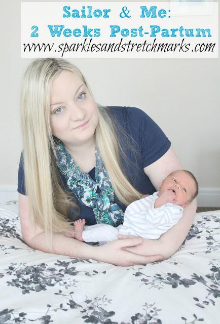 2 weeks post partum c section