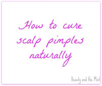 How to Cure Scalp Pimples Naturally?