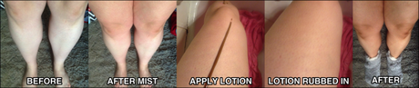 BeforeAfterLotion