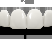 Change Your Smile Without Visiting Dentist with Brighter Image Labs Innovative Press Veneers!