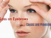 Hair Loss Eyebrows: Causes Prevention Tips