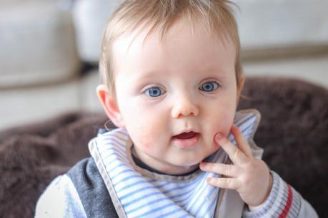 Logan at 8 and 9 Months Logan at 8 and 9 Months