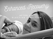 Enhanced Recovery After Elective C-Section