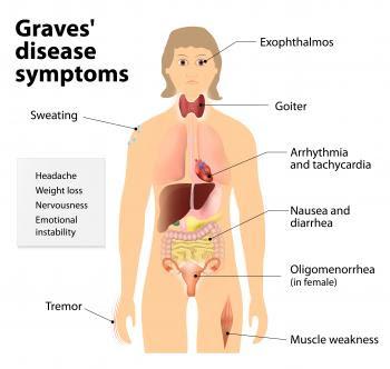 WHAT'S HAPPENING// Graves' Disease