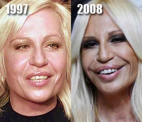 Donatella Versace before plastic surgery