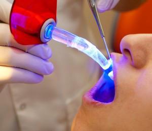 Minimally Invasive Dentistry