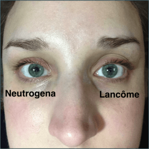Lacome Vs Neutrogena