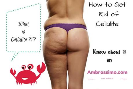 Cellulite is the buildup of fat under a person’s skin. 