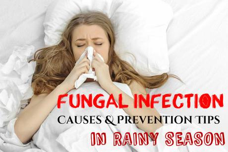 Fungal Infection Causes Prevention Tips