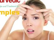 Best Ayurvedic Beauty Tips Treatment Pimples