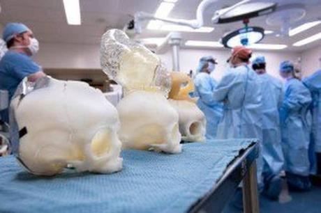 Models of skulls in the surgery room/Boston Children's Hospital photo