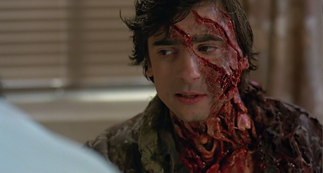 Screenshot Saturday: John Landis’ An American Werewolf in London (1981) pt. II