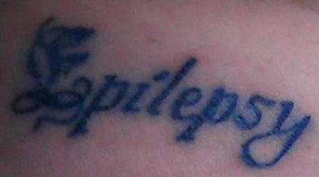 Epilepsy Medical Tattoo Life Saving Medical Tattoos To Alert People