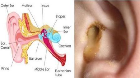 Said goodbye to ear infection! here’s how to cure an ear infection naturally in just one day! ear-infection