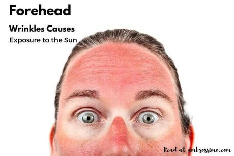 Exposure to the Sun - Forehead Wrinkles Causes
