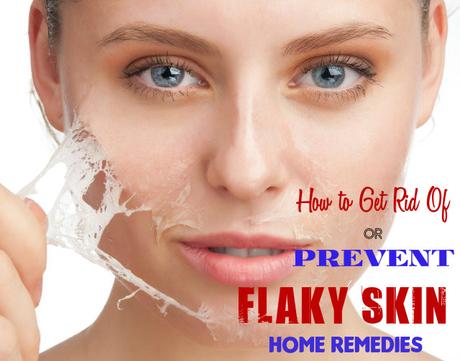 Flaky Skin Home Remedies