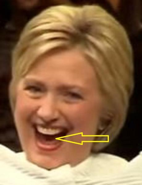 Hillary's tongue 0.00