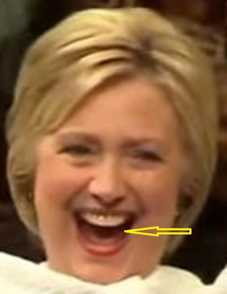 Hillary's tongue 0.01