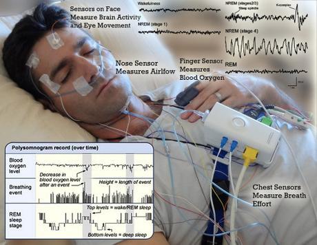 sleepstudy