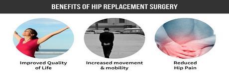 Low Cost Effective Benefits of Total Hip Replacement Surgery in India with Best hospitals & Top Hip Surgeons in India