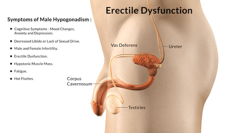 symptoms of erectile dysfunction