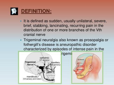 trigeminal-neuralgia-13-638