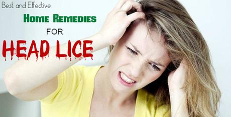 Home Remedies for Head Lice