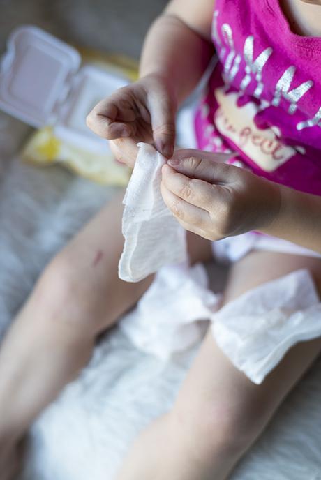 Prepping your child's skin for the winter doesn't have to be difficult. Read more on how to take care of it and avoid dry and chapped skin on your child's delicate and sensitive skin. 