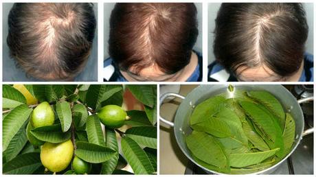 Guava Leaves – the magical medicine for Hair Growth