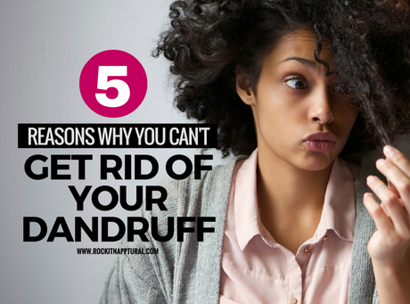 Dandruff and natural hair