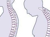 Breast Cancer Osteoporosis