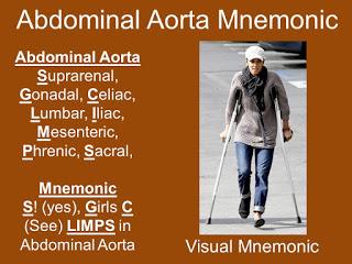 Visual mnemonic for Abdominal Aorta Branches List 