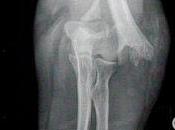 Missouri Prosecutor Files Criminal Charges Against Wife Over Incident Where Sheriff's Deputy Shattered During Unlawful Eviction September 2015