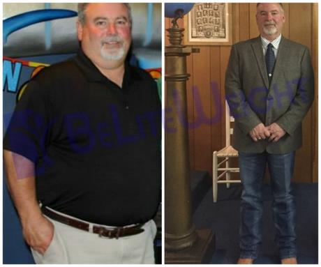 Turn My Life Around: Michael’s Gastric Sleeve