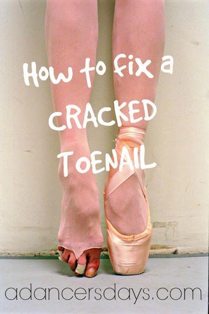 how to fix a cracked toenail