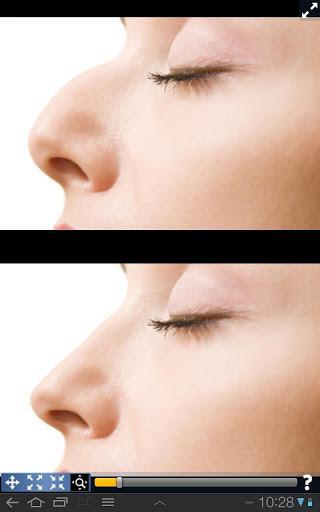 Plastic Surgery Simulator v1.2.12 APK