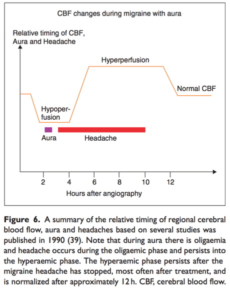 What is a headache?, The four most common types of headache, and can you hurt your brain by thinking too much?