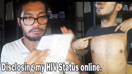 Let Me Disclose My HIV Status; Why I Am Passionate About HIV & AIDS Awareness?