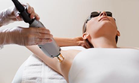 5 Irresistible Reasons Why Laser Hair Removal is a Smart Choice