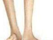 Ayurvedic Treatment Herditary Moto Sensory Neuropathy