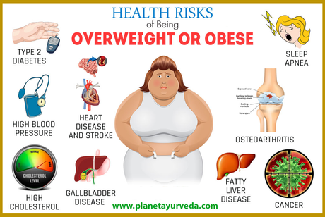 Obesity/Overweight Risk Factors and Causes -Weight loss Herbal Supplements