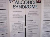 Home POPFASD Fetal Alcohol Spectrum Disorder (FASD