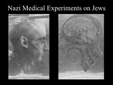 Medical Experimentation on Human Subjects by Nazi Germany