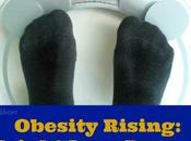 Obesity Rising: Weight Loss Surgery Answer?