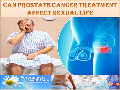 Can Prostate Cancer Affect your Sexual Life