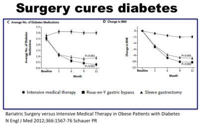 Is Bariatric Surgery Like Fasting in Type 2 Diabetes Treatment?