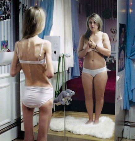 body-dysmorphic-disorder.jpg