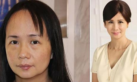 Resurface Your Skin With Best Beauty Treatments Available In HongKong!