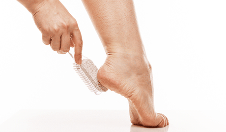What Causes Foot Calluses and Corns?